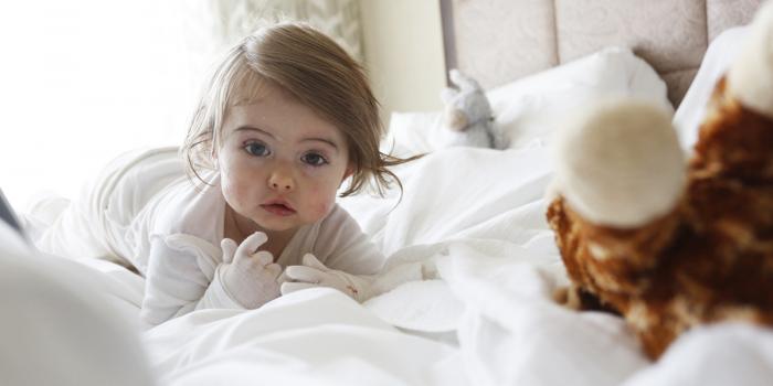 This photo is of a baby with Epidermolysis Bullosa (EB).