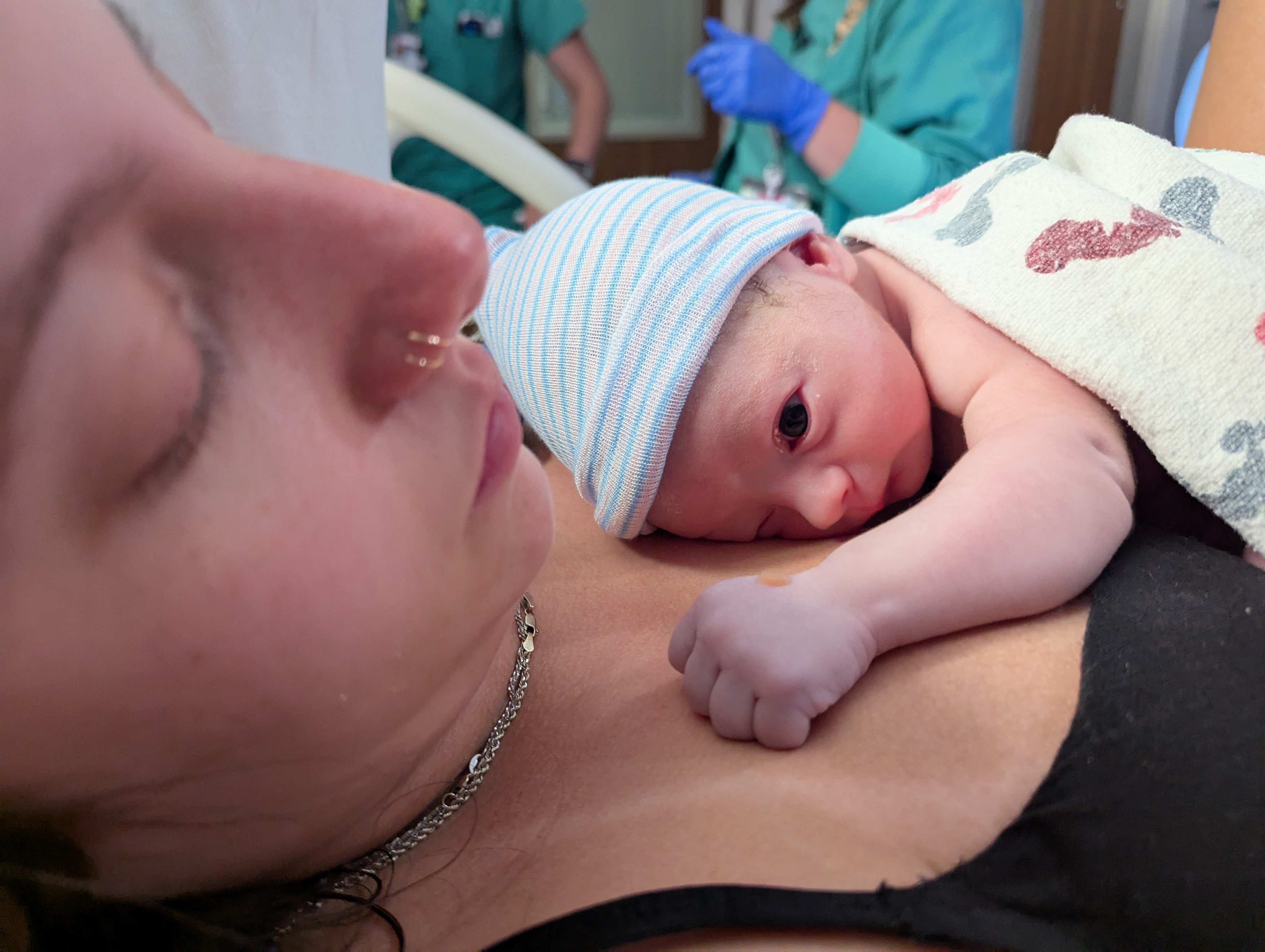 Epidermolysis Bullosa Personal Story