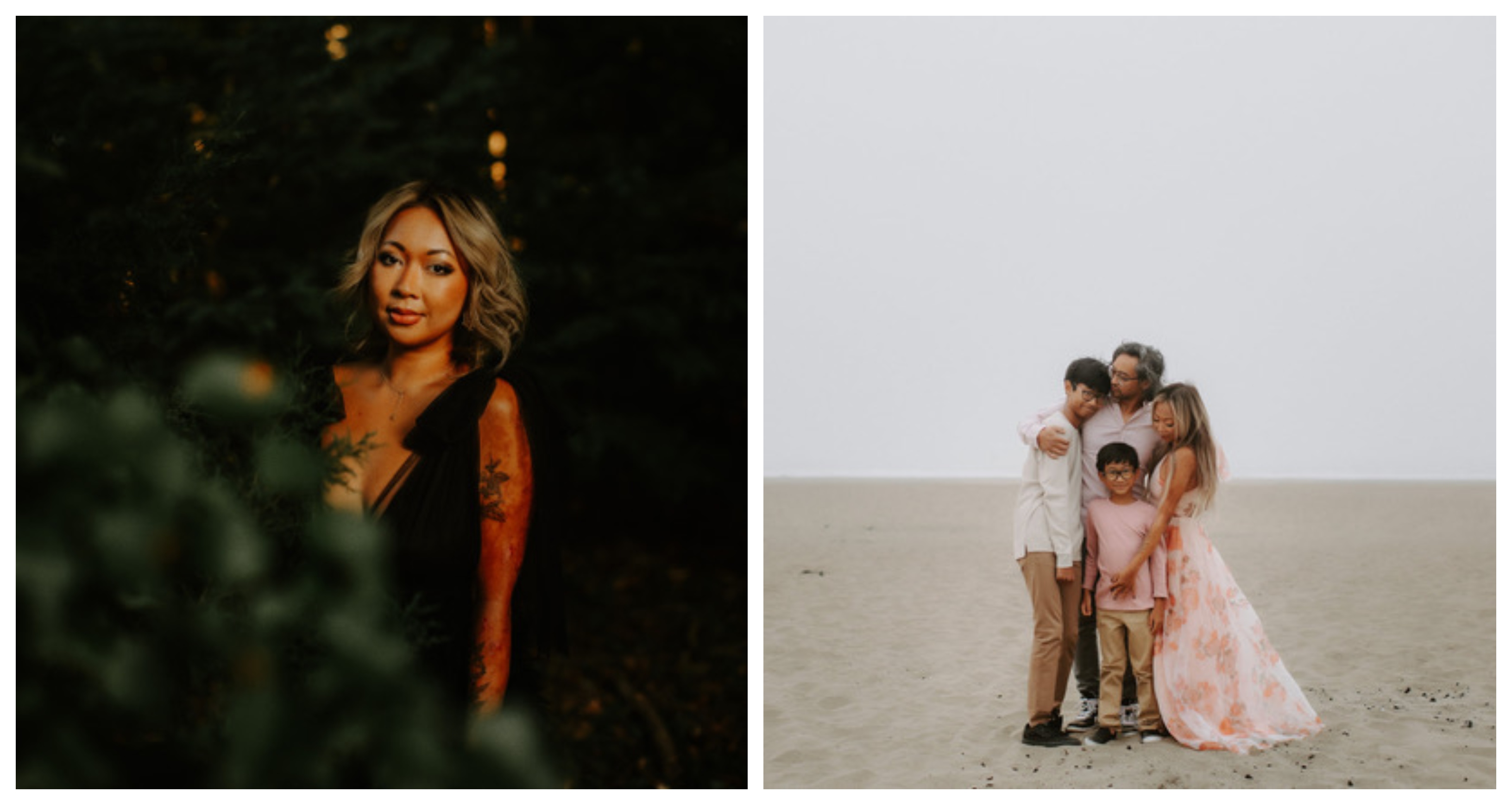 Epidermolysis Bullosa Personal Story