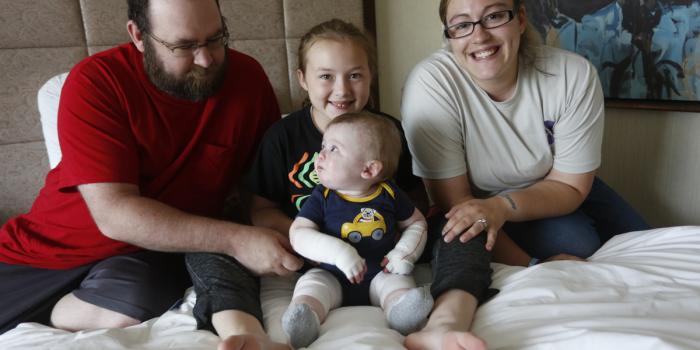 This photo is of a smiling family with baby with Epidermolysis Bullosa (EB).