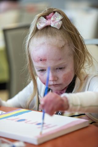 A young girl with EB painting.