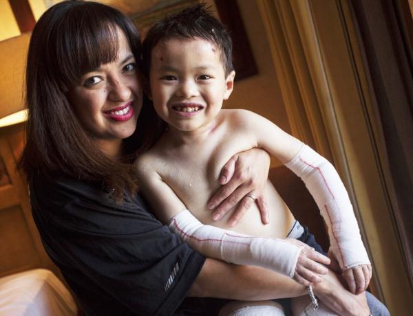 This photo is of a mother embracing her son with Epidermolysis Bullosa (EB).
