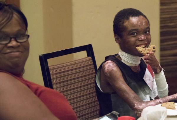 This is a photo of a young boy with Epidermolysis Bullosa (EB) eating cookie and smiling.